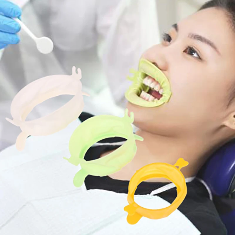 3Pcs S/M/L Dental Lip Cheek Re - Teeth Whitening Accelerator ulasan dan harga