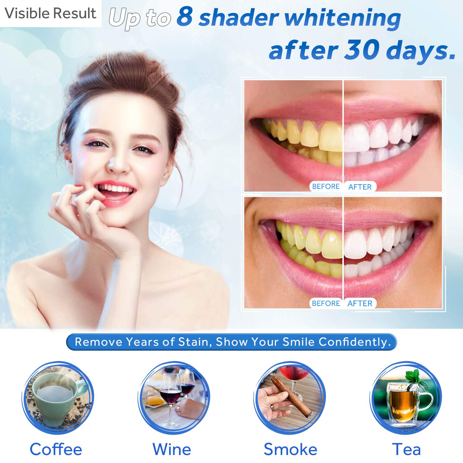 Teeth Whitening Gel Refill Syr - Teeth Whitening Near Me ulasan dan harga
