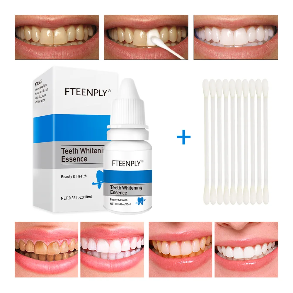 FTEENPLY Teeth Whitening Essen - Teeth Whitening Near Me ulasan dan harga