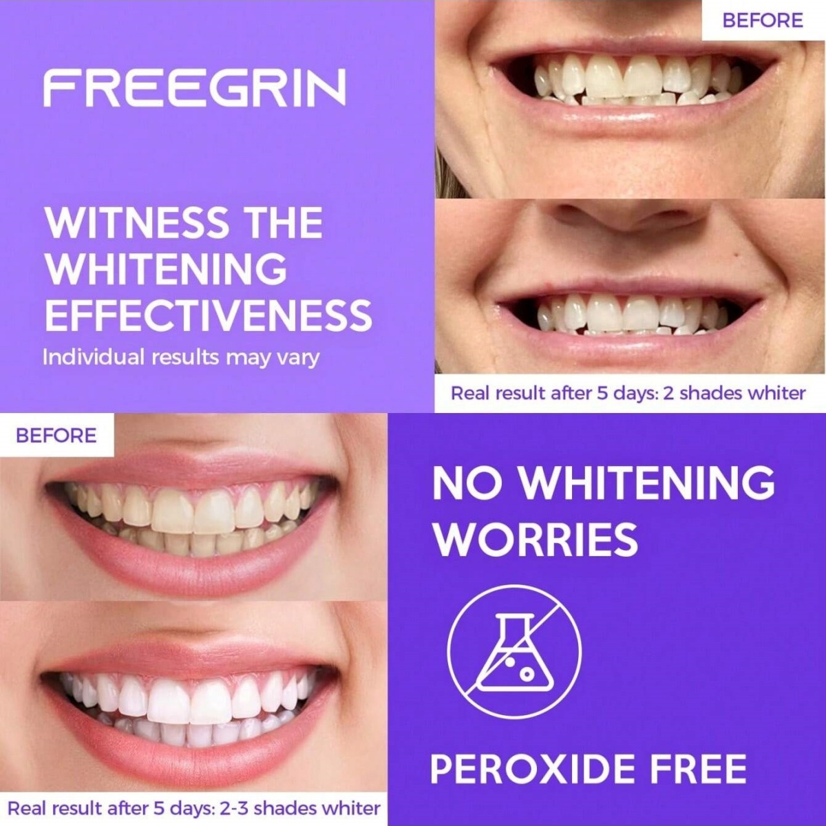 Deluxe Whitening Teeth Sticker - Teeth Whitening Near Me ulasan dan harga