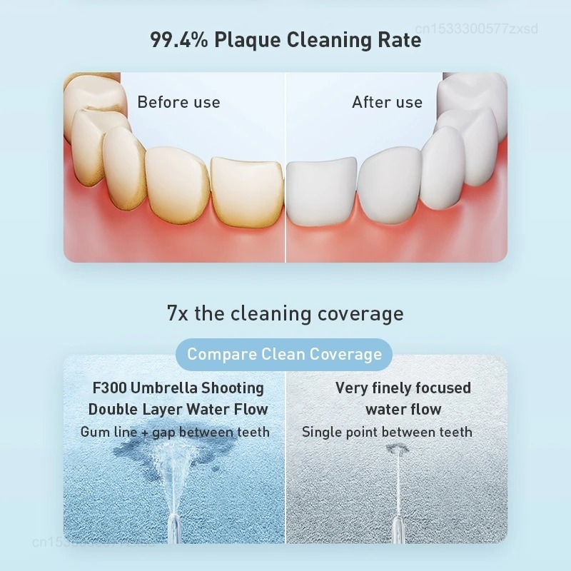 XIAOMI MIJIA Portable Oral Irr - Water Flosser Cordless ulasan dan harga